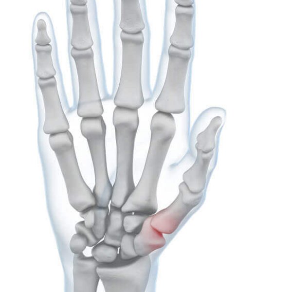 Illustration der Anatomie der Hand bei auftretenden Schmerzen im Daumengelenk